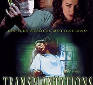 Transplantations