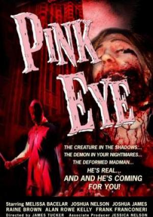 Pink Eye