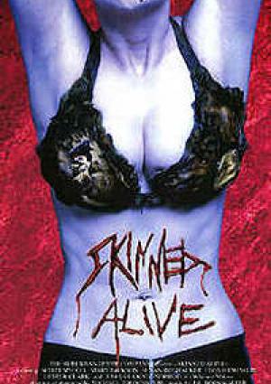 Skinned Alive