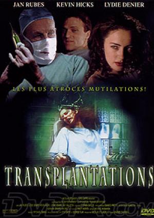 Transplantations