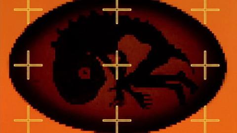 Épisode 10 – Magmadiver