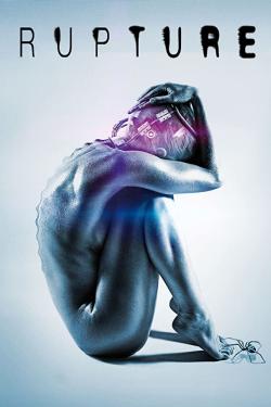 Rupture