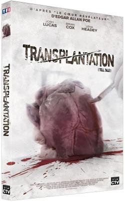 Transplantation