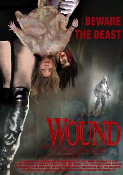 Wound