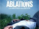 Ablations : extrait exclusif !