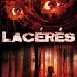 Lacérés