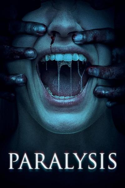 Paralysis
