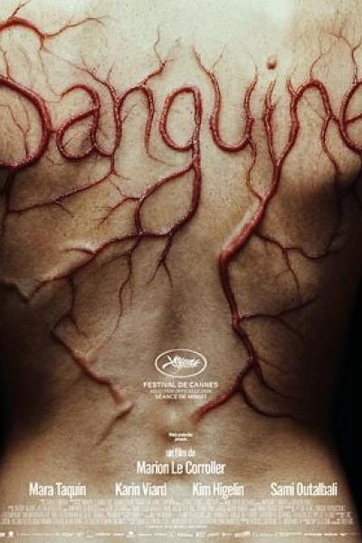 Sanguine