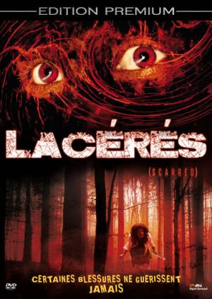 Lacérés