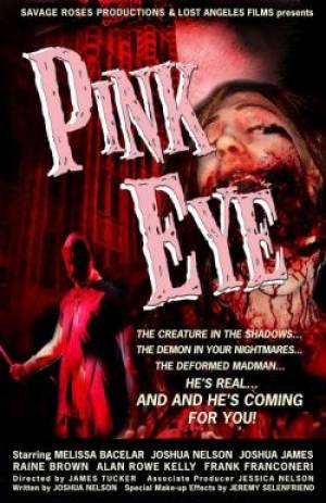 Pink Eye