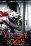 Visible Scars Visible Scars